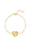 Bracelet Baloov